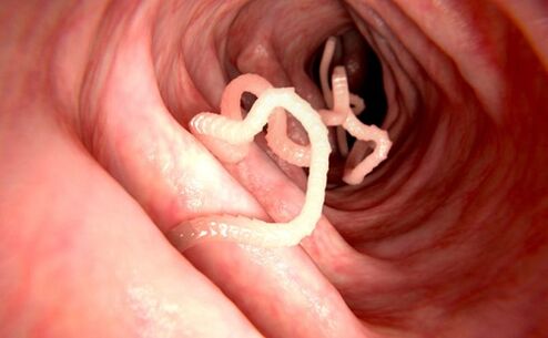červi v lidském těle