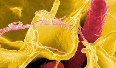 Známky parazitů v lidském těle