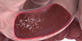 Použití trojčat k odstranění parazitů