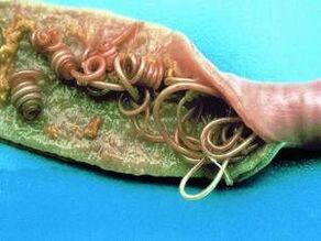 Příčiny parazitů v lidském těle