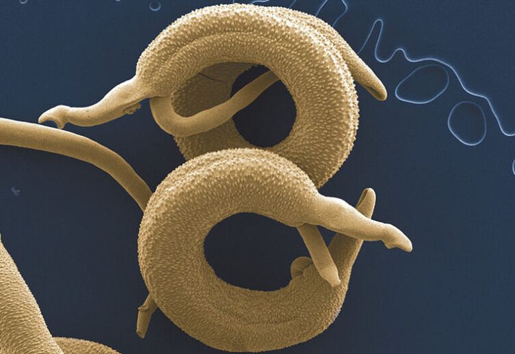 parazitů žijících v lidském těle